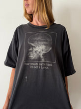 "It's Not A Tumor" Skull Tee